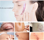 Crème réparatrice de cicatrices